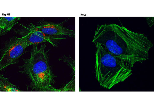  Confocal immunofluorescent analysis of Hep G2 (left) or HeLa (right) cells using AFP (3H8) Mouse mAb (Alexa Fluor® 555 Conjugate) (red). Actin filaments were labeled with Alexa Fluor® 488 phalloidin (green). Blue pseudocolor = DRAQ5® #4084 (fluorescent DNA dye).