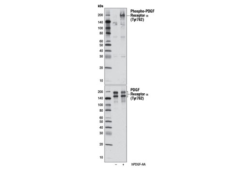 Western blot analysis of extracts from NCI-H1703 cells serum-starved overnight, untreated (-) or treated with Human Platelet-Derived Growth Factor AA (hPDGF-AA) #8913 (100 ng/ml, 10 min;+), using Phospho-PDGF Receptor α (Tyr762) Antibody (upper) or PDGF Receptor α (D13C6) XP® Rabbit mAb #5241 (lower).