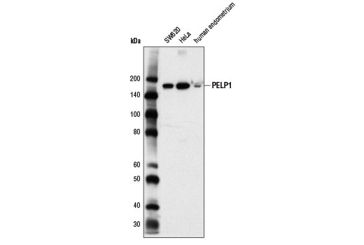 Western blot analysis of extracts from SW620 cells, HeLa cells, and human endometrium using PELP1 Antibody.