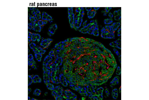 Confocal immunofluorescent analysis of rat pancreas using VEGF Receptor 2 (D5B1) Rabbit mAb (Alexa Fluor® 555 Conjugate) (red) and β-Catenin (L54E2) Mouse mAb (IF Preferred) #2677 (green). Blue pseudocolor = DRAQ5® #4084 (fluorescent DNA dye).