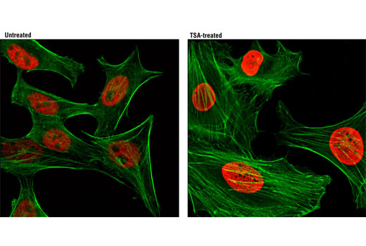  Confocal immunofluorescent analysis of HeLa cells, untreated (left) or treated with Trichostatin A (TSA) #9950 (right), using Acetyl-Histone H3 (Lys9) (C5B11) Rabbit mAb (Alexa Fluor® 594 Conjugate) (red). Actin filaments were labeled with Alexa Fluor® 488 phalloidin (green).
