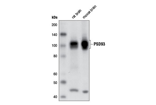 Western blot analysis of extracts from rat and mouse brain using PSD93 Antibody.