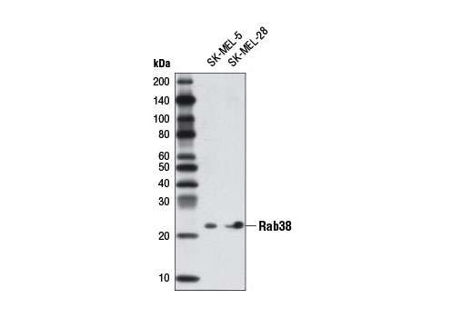 Western blot analysis of extracts from SK-MEL-5 and SK-MEL-28 cells using Rab38 Antibody.