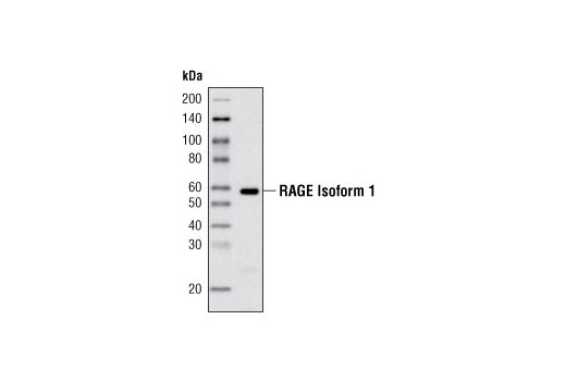 Western blot analysis of extract from human lung tissue using RAGE 1 Antibody.