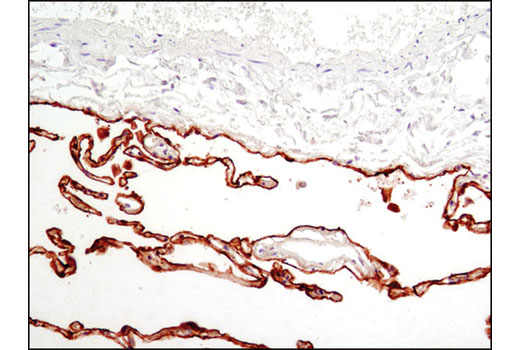 Immunohistochemical analysis of paraffin-embedded human normal lung using Rage 1 Antibody.