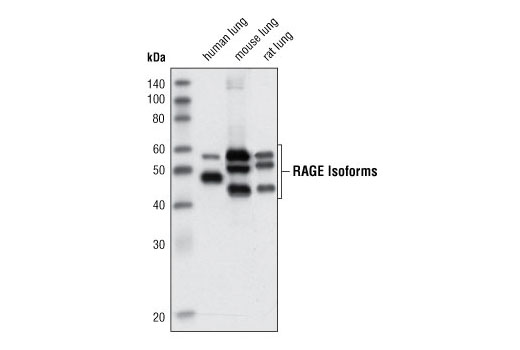 Western blot analysis of extracts from human, mouse and rat lung tissue using RAGE Antibody.