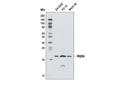 Western blot analysis of extracts from various cell lines using RGS4 Antibody.