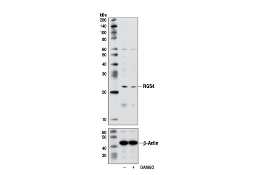 Western blot analysis of extracts from SH-SY5Y cells, untreated (-) or treated (+) with DAMGO (1 μM, 16 hr), using RGS4 Antibody and β-Actin (13E5) Rabbit mAb #4970.
