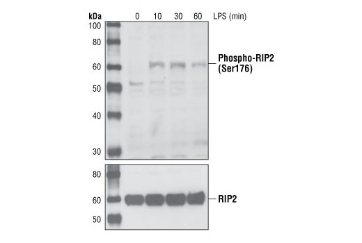 Western blot analysis of extracts from PMA differentiated THP-1 cell lysates untreated or treated with LPS, using Phospho-RIP2 (Ser176) Antibody.