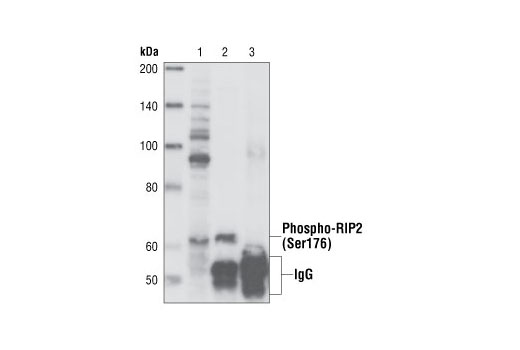 Western blot analysis of extracts and immunoprecipitates from PMA differentiated, LPS induced (10 minutes) THP-1 cell lysates (lane 1). Phospho-RIP2 (Ser176) was immunoprecipitated with Phospho-RIP2 (Ser176) Antibody (lane 2), and specificity was confirmed by immunprecipitation with rabbit IgG (lane 3). Immunoblot was performed using Phospho-RIP2 (Ser176) Antibody.
