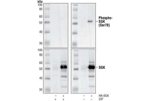 Western blot analysis of extracts from HeLa cells untransfected (left lane) and transfected by HA-SGK (right lane), using Phospho-SGK (Ser78) Antibody (upper) or control SGK Antibody #3272 (lower). The phospho-specificity of the antibody was characterized by treating the membrane with or without calf intestinal alkaline phosphatase (CIP) after Western transfer.