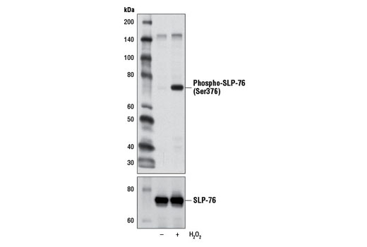 Western blot analysis of extracts from EL4 cells, untreated (-) or treated with H2O2 (11 mM, 1 min; +), using Phospho-SLP-76 (Ser376) Antibody (upper) or SLP-76 Antibody #4958 (lower).