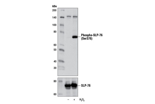 Western blot analysis of extracts from Jurkat cells, untreated (-) or treated with H2O2 (11 mM, 1 min; +), using Phospho-SLP-76 (Ser376) Antibody (upper) or SLP-76 Antibody #4958 (lower).