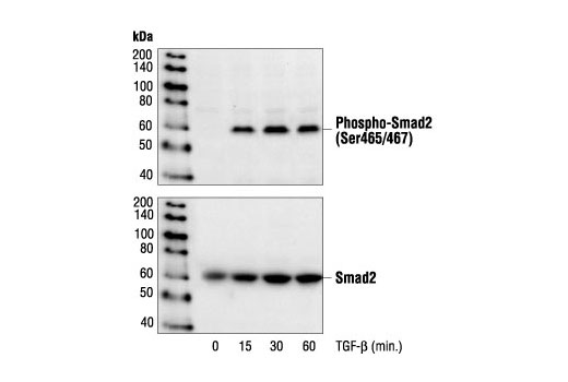Western blot analysis of extracts from HepG2 cells treated with TGFbeta for the indicated times, using Phospho-Smad2 (Ser465/467) Antibody (upper) or Smad2 antibody (lower).