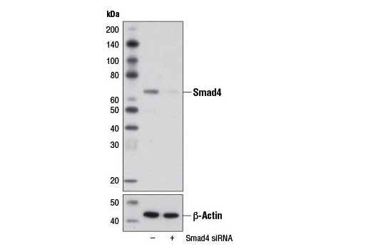 Western blot analysis of extracts from NIH/3T3 cells, transfected with 100 nM SignalSilence® Control siRNA (Unconjugated) #6568 (-) or SignalSilence® Smad4 siRNA I (Mouse Specific) (+), using Smad4 Antibody #9515 (upper) or β-Actin (D6A8) Rabbit mAb #8457 (lower). The Smad4 Antibody confirms silencing of Smad4 expression, while the β-Actin (D6A8) Rabbit mAb is used as a loading control.