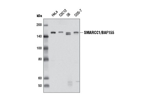 Western blot analysis of extracts from various cell lines using SMARCC1/BAF155 Antibody.