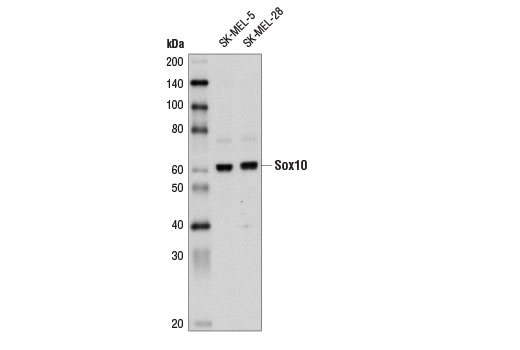 Western blot analysis of extracts from SK-MEL-5 and SK-MEL-28 cells using Sox10 Antibody.