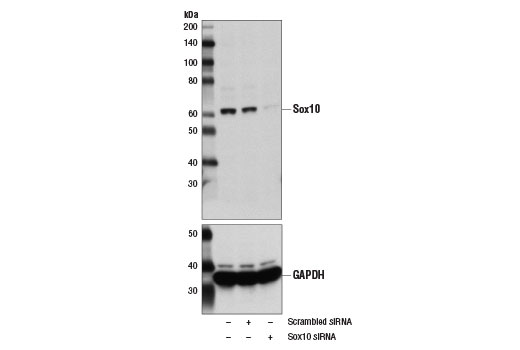 Western blot analysis of extracts from SK-MEL-28 cells, mock transfected (-) or transfected with scrambled control siRNA (+) or Sox10 specific siRNA (+), using Sox10 Antibody (upper) and GAPDH (D16H11) XP® Rabbit mAb #5174 (lower). The Sox10 specific siRNA confirms Sox10 antibody specificity, while the GAPDH (D16H11) XP® Rabbit mAb is used as a loading control.