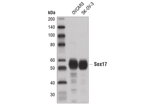 Western blot analysis of extracts from OVCAR3 and SK-OV-3 cells using Sox17 Antibody.