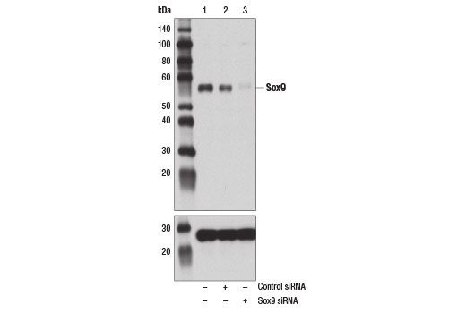 Western blot analysis of extracts from A-204 cells, mock transfected (-), transfected with scrambled control siRNA (+), or transfected with Sox9 specific siRNA (+) using Sox9 Antibody (upper) and GAPDH (D16H11) XP® Rabbit mAb #5174. The siRNA specific knockdown of Sox9 confirms the specificity of the Sox9 antibody and GAPDH is used as a loading control.
