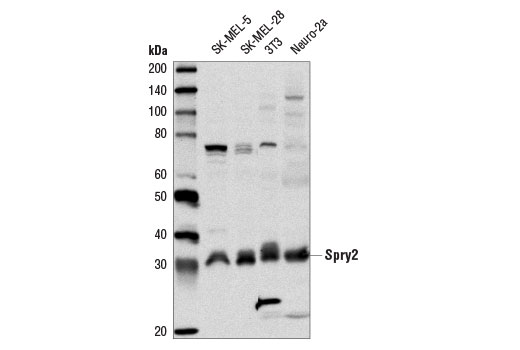 Western blot analysis of extracts from various cell lines using Spry2 Antibody.