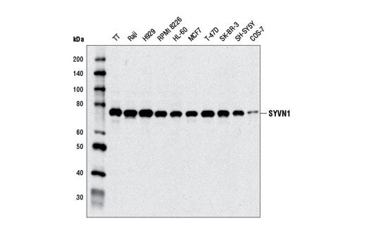 Western blot analysis of extracts from various cell lines using SYVN1 Antibody.