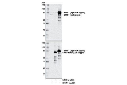 Western blot analysis of extracts from 293T cells, mock transfected (-) or transfected with constructs expressing Myc/DDK-tagged full-length human SYVN1 (hSYVN1-Myc/DDK; +) or Myc/DDK-tagged full-length human AMFR (hAMFR-Myc/DDK; +), using SYVN1 Antibody (upper) and DYKDDDDK Tag Antibody #2368 (lower).