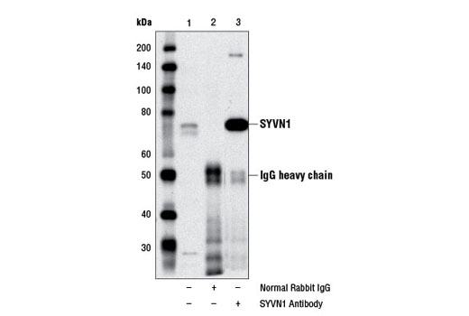 Immunoprecipitation of SYVN1 from HeLa cell extracts using Normal Rabbit IgG #2729 (lane 2) or SYVN1 Antibody (lane 3). Lane 1 is 10% input. Western blot analysis was performed using SYVN1 Antibody.