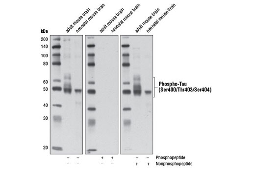 Western blot analysis of extracts from adult and neonatal mouse brain using Phospho-Tau (Ser400/Thr403/Ser404) Antibody. The phospho-specificity of the antibody was verified by blocking with a Ser400/Thr403/Ser404 phosphopeptide (middle panel) or a nonphosphopeptide (right panel).