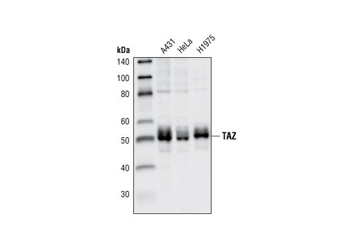 Western blot analysis of extracts of A431, HeLa and H1975 cells using TAZ Antibody.