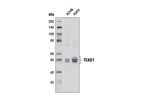 Western blot analysis of extracts from ACHN and A549 cells using TEAD1 Antibody.
