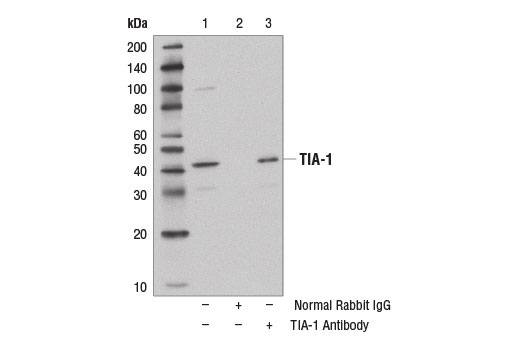 Immunoprecipitation of TIA-1 from Jurkat cell extracts using Normal Rabbit IgG #2729 (lane 2) or TIA-1 Antibody (lane 3). Lane 1 is 10% input. Western blot was performed with TIA-1 Antibody. A Mouse Anti-rabbit IgG (Conformation Specific) (L27A9) mAb #3678 was used as a secondary antibody to prevent reactivity with IgG heavy chain.