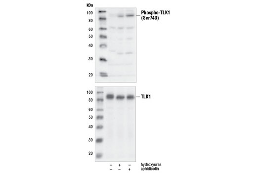 Western blot analysis of extracts from HeLa cells, untreated or treated overnight with hydroxyurea or aphidicolin, using Phospho-TLK1 (Ser743) Antibody (upper), or TLK1 Antibody #4125 (lower).
