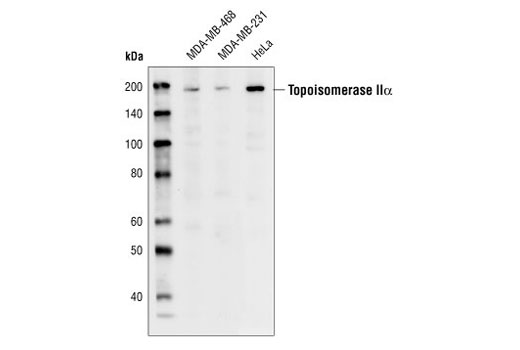 Western blot analysis of extracts from MDA-MB-468, MDA-MB-231 and HeLa cells, using Topoisomerase IIalpha Antibody.