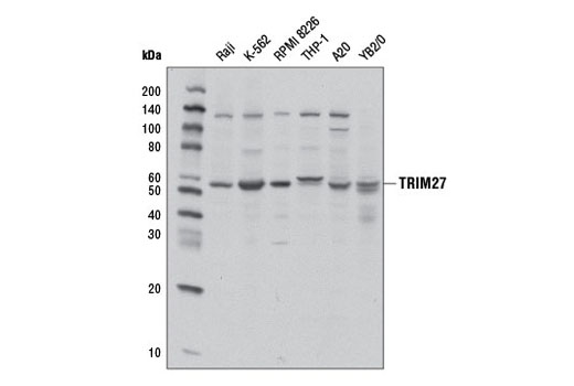 Western blot analysis of extracts from various cell lines using TRIM27 Antibody.