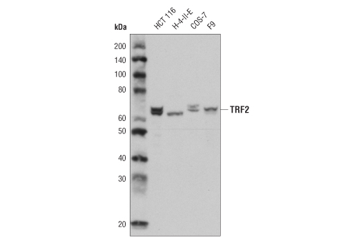 Western blot analysis of extracts from various cell lines using TRF2 (D1Y5D) Rabbit mAb.