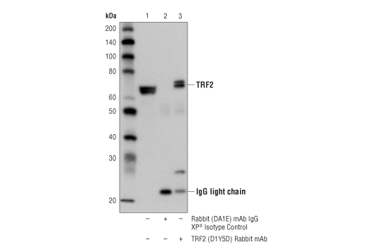 Immunoprecipitation of TRF2 from HCT 116 cell extracts using Rabbit (DA1E) mAb IgG XP ® Isotype Control #3900 (lane 2) or TRF2 (D1Y5D) Rabbit mAb (lane 3). Lane 1 is 10% input. Western blot analysis was performed using TRF2 (D1Y5D) Rabbit mAb.
