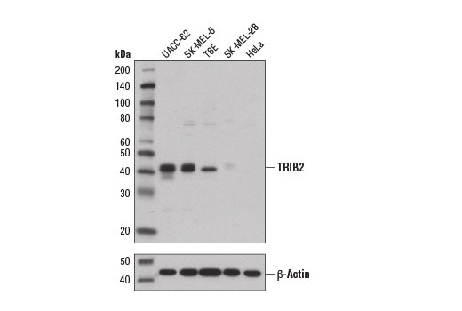Western blot analysis of extracts from various cell lines using TRIB2 (D8P2X) Rabbit mAb.