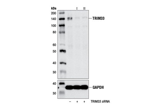 Western blot analysis of extracts from 293T cells, transfected with 100 nM SignalSilence ® Control siRNA (Unconjugated) #6568 (-), SignalSilence ® TRIM33 siRNA I #13487 (+), or SignalSilence ® siRNA II #13503 (+), using TRIM33 (E1N2Z) Rabbit mAb (upper) or GAPDH (D16H11) XP ® Rabbit mAb #5174 (lower). The TRIM33 (E1N2Z) Rabbit mAb confirms silencing of TRIM33, while the GAPDH (D16H11) XP ® Rabbit mAb is used as a loading control.