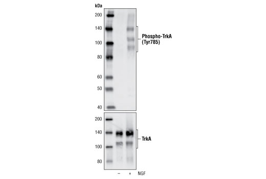 Western blot analysis of extracts from NIH/3T3 cells transfected with TrkA, untreated or treated with NGF, using Phospho-TrkA (Tyr785)/TrkB (Tyr816) (C67C8) Rabbit mAb (upper) and TrkA (14G6) Rabbit mAb #2508 (lower).
