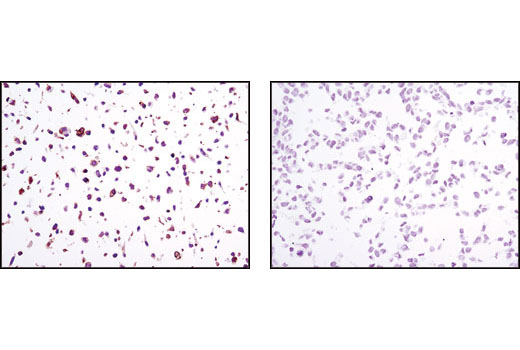 Immunohistochemical analysis of paraffin-embedded NIH/3T3/TrkB (left) or NIH/3T3/TrkA (right) cell pellets using TrkB (80G2) Rabbit mAb.