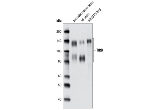Western blot analysis of extracts from neonatal mouse brain, rat brain and NIH/3T3/TrkB cells using TrkB (80E3) Rabbit mAb.