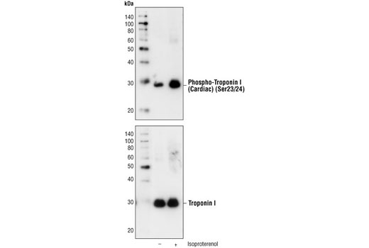 Western blot analysis of extracts from mouse myocytes, untreated or stimulated with isoproterenol, using Phospho-Troponin I (Cardiac) (Ser23/24) Antibody (upper) or Troponin I Antibody #4002 (lower).