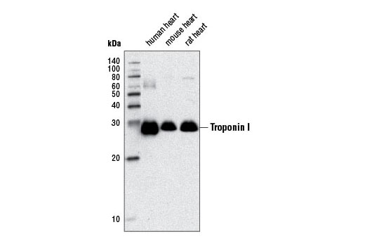 Western blot analysis of extracts from human, mouse and rat heart tissue using Troponin I (D6F8) Rabbit mAb.