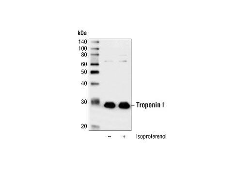 Western blot analysis of extracts from unstimulated and isoproterenol stimulated myocytes, using Troponin I Antibody.