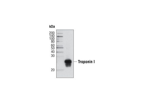 Western blot analysis of extracts from human heart tissue using Troponin I Antibody.