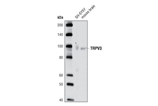 Western blot analysis of extracts from SH-SY5Y cells and mouse brain using TRPV3 Antibody.