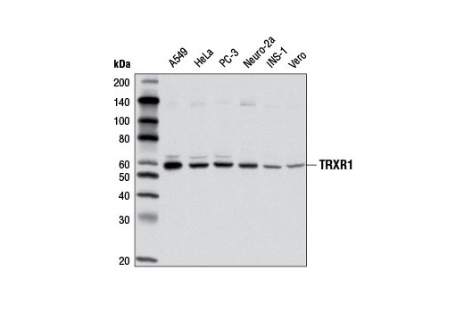 Western blot analysis of extracts from various cell lines using TRXR1 Antibody.