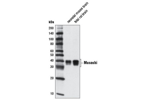 Western blot analysis of extracts from neonatal mouse brain and fetal rat brain using Musashi-1 (D46A8) XP ® Rabbit mAb.