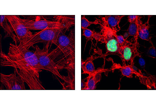 Confocal immunofluorescent analysis of 3T3-L1 cells, untreated (left) or staurosporine-treated (right), using Cleaved PARP (Asp214) Antibody (Mouse Specific) (green). Actin filaments have been labeled with DY-554 phalloidin (red). Blue pseudocolor = DRAQ5® #4084 (fluorescent DNA dye).